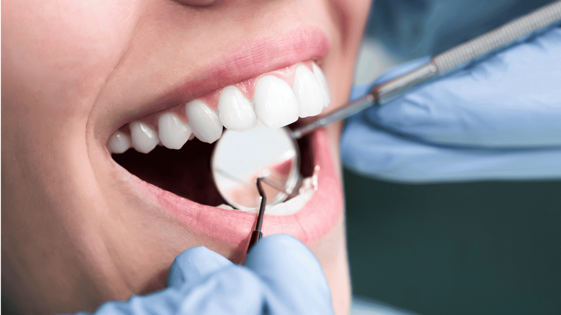 Dental Crown Treatment | Oxnard & Santa Paula | Lifetime Dental