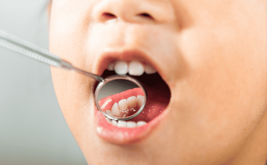 Pediatric dentist in Oxnard and Santa Paula.