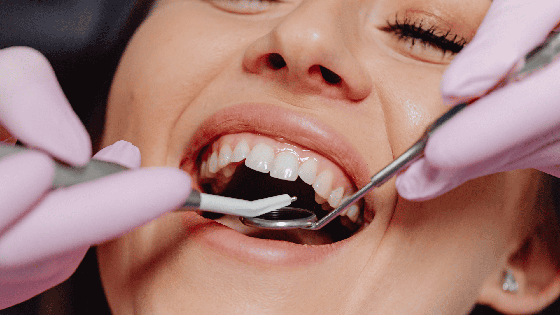 Need a tooth pulled in Oxnard, CA? Lifetime Dental Care provides comfortable tooth extractions at three convenient locations. Call us today!