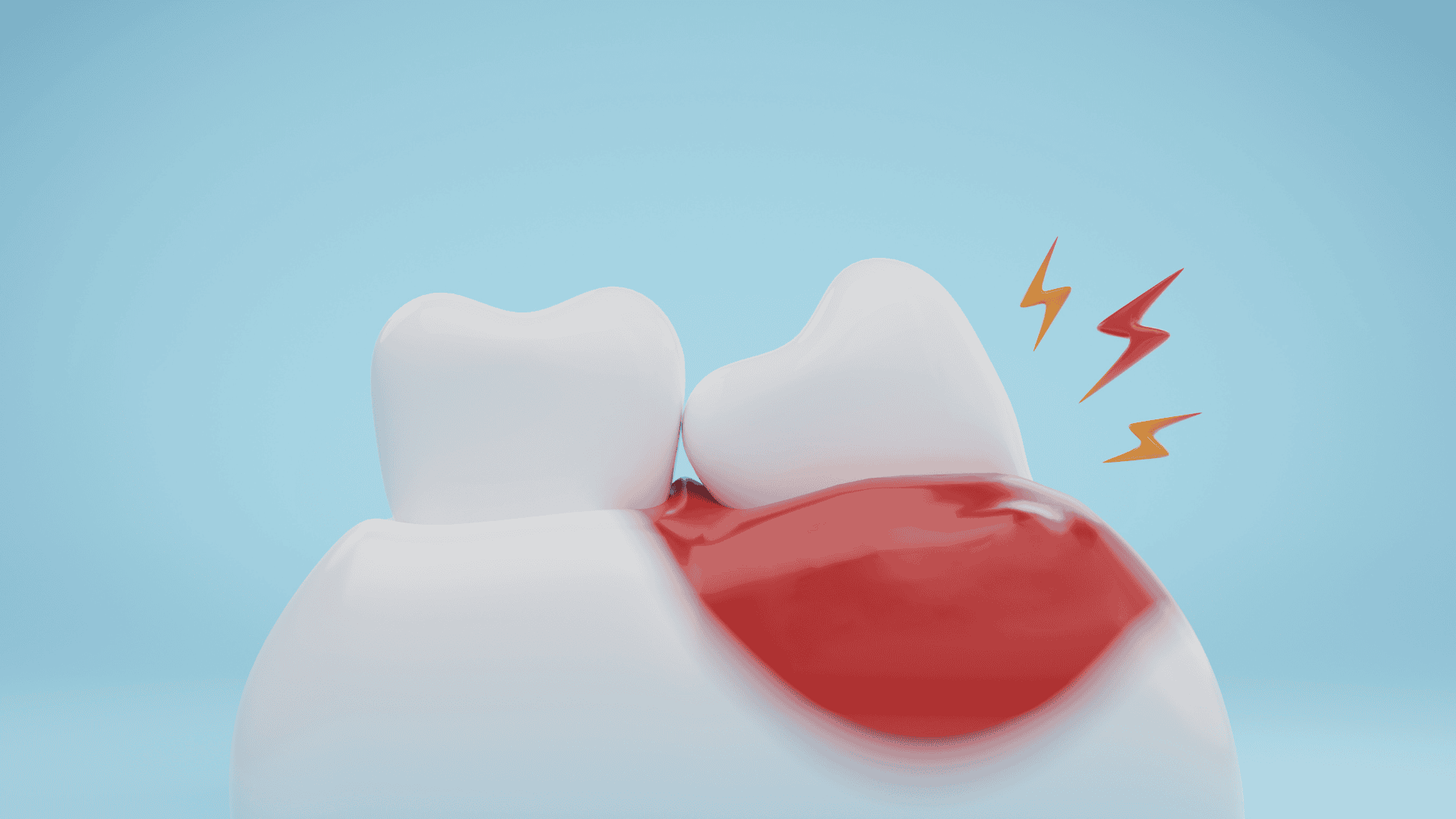 Need your wisdom teeth removed in Oxnard, CA? Lifetime Dental Care provides gentle wisdom tooth extraction at three convenient locations.